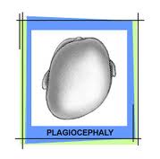 Plagiocephaly Button
