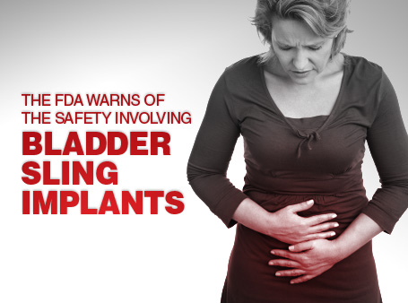 The FDA Warns of the Safety involving Bladder Sling Implants